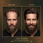 Lolay Naturals Hair Moustache & Beard Oil โ Before & After