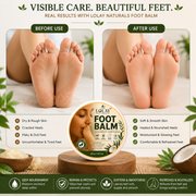 Crack Free Foot Balm 20gm