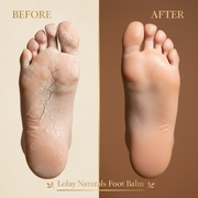 Foot Balm