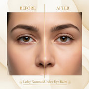 Lolay Naturals Under Eye Balm – Before & After